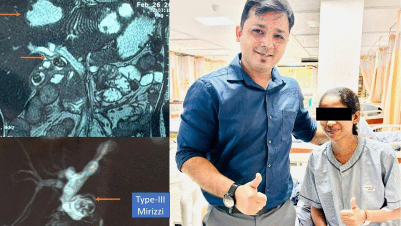 পিত্তথলিতে আশঙ্কাজনক ‘সেপসিস’, জটিল অস্ত্রোপচারে প্রাণ বাঁচল ২৮ বছরের তরুণীর