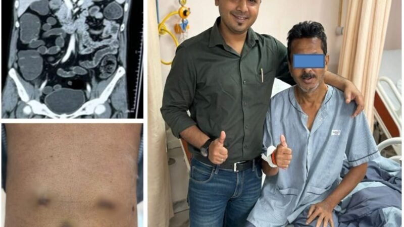 জটিল হৃদরোগ সঙ্গে পেটের ক্যানসার, মিনিমাল অ্যাক্সেস সার্জারির মাধ্যমে প্রাণ বাঁচল রোগীর