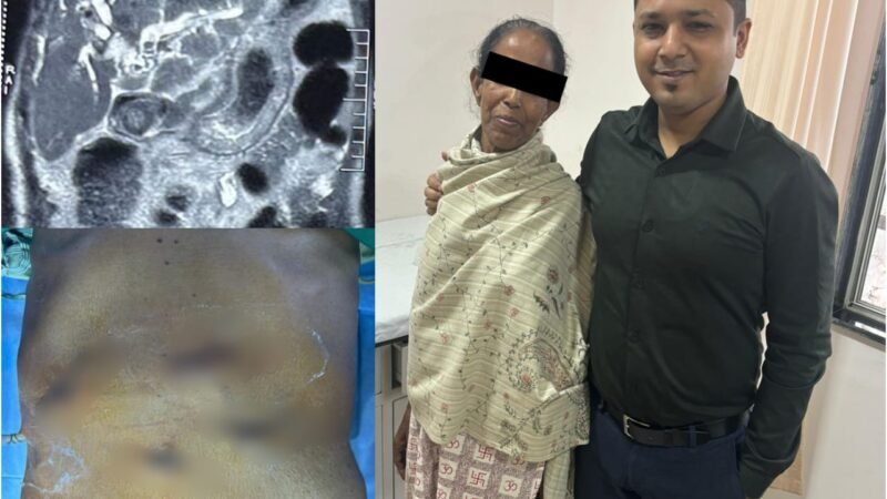 জটিল পিত্তনালির রোগে ল্যাপারোস্কোপিক সার্জারিতে নতুন নজির দুর্গাপুরে